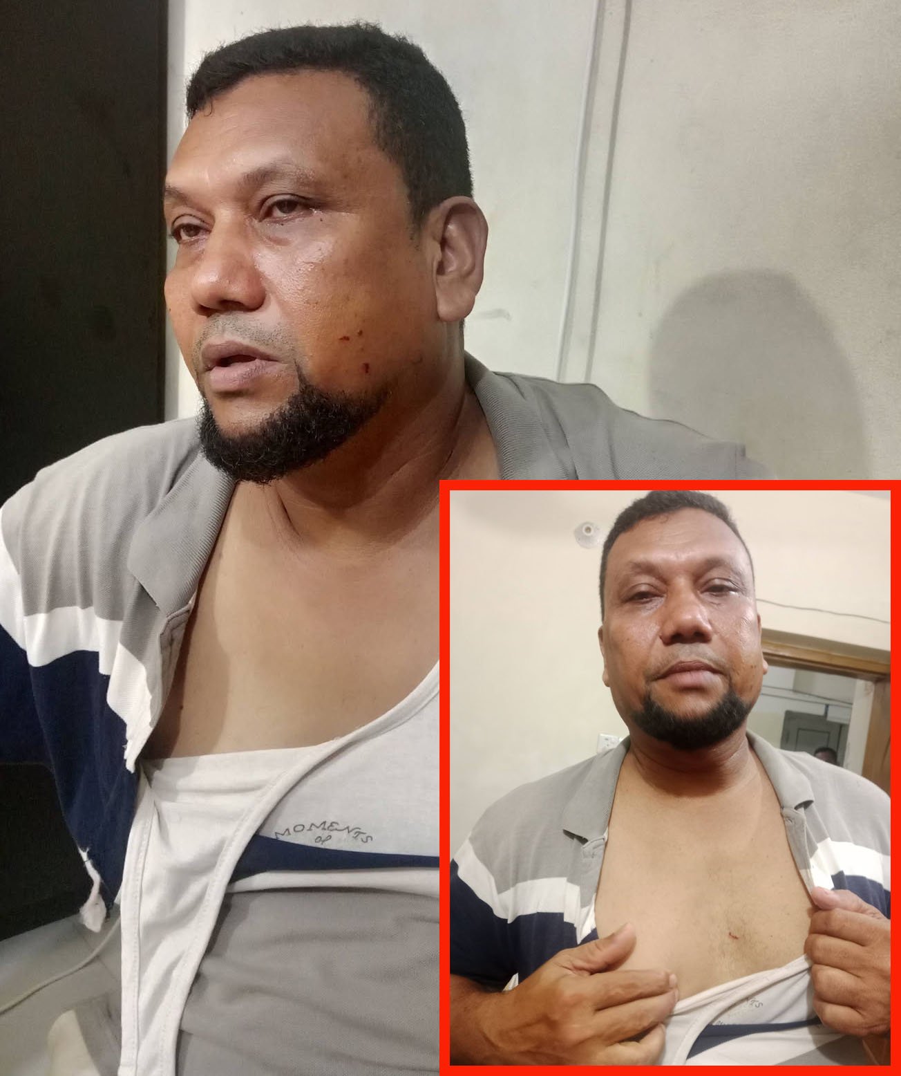 চন্দনাইশেত্রাণ বিতরণে অনিয়মের প্রতিবাদ করায় বিএনপি নেতা আহত
